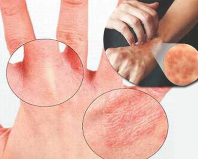 Cách lọc nước giếng khoan đơn giản tại nhà